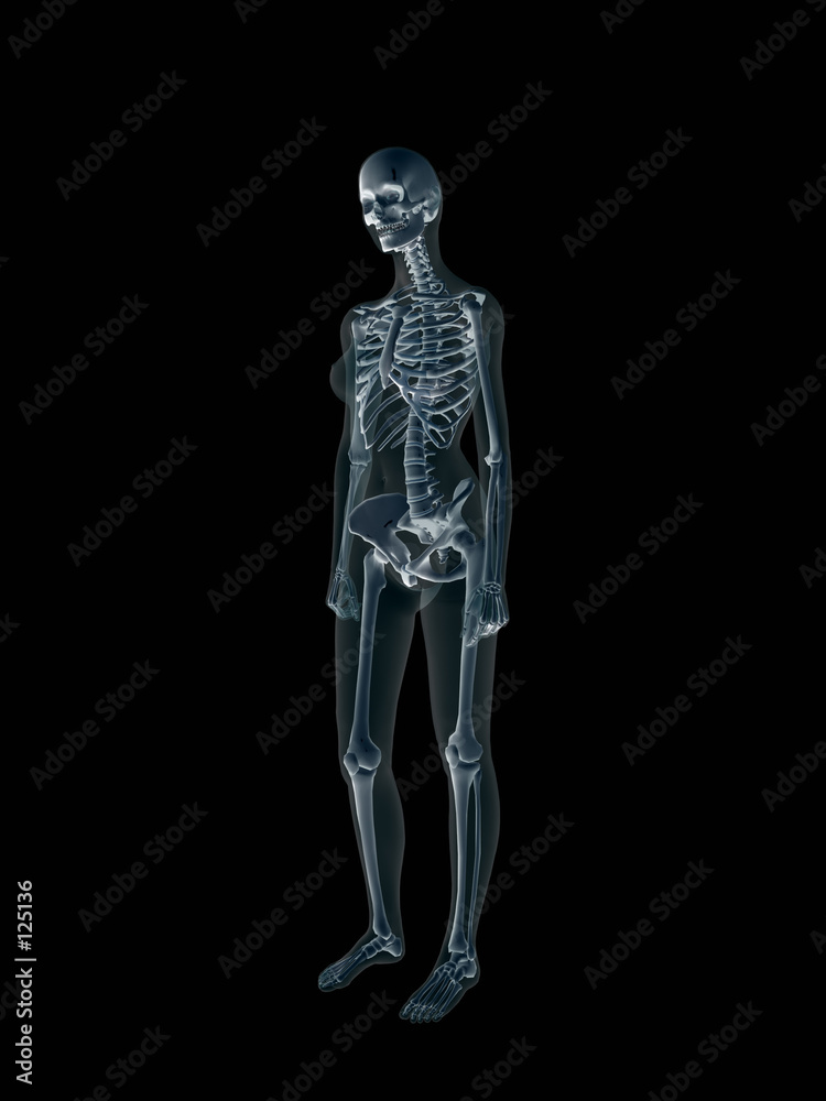 xray, x-ray of the human female body.