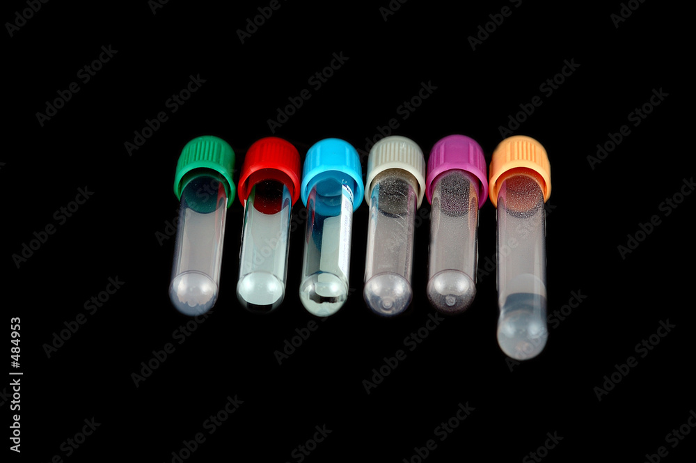 specimen tube specimen tube
