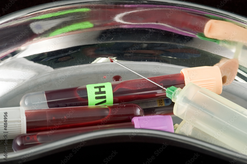 Fototapeta premium aids test