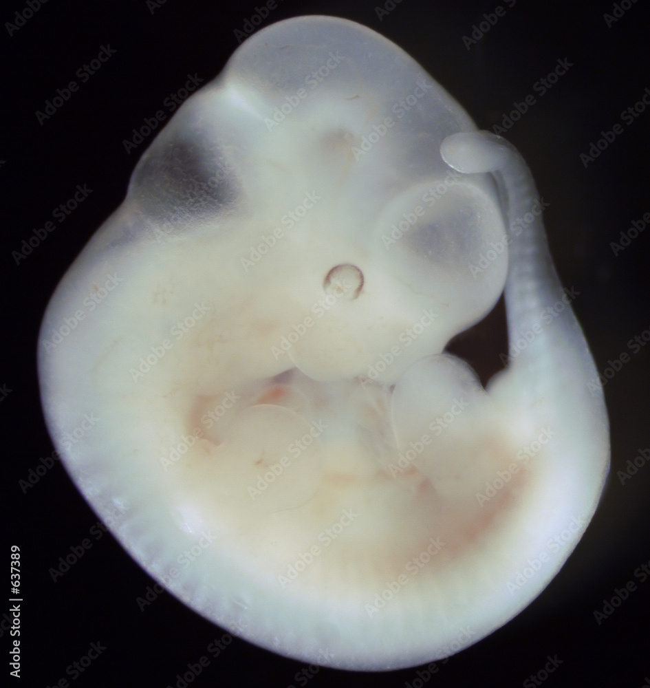 Φωτογραφία mouse embryo, day 11 of development