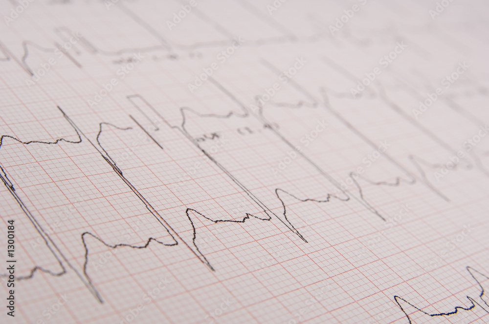 electrocardiogram electrocardiogram