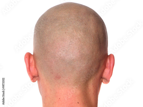 bald man