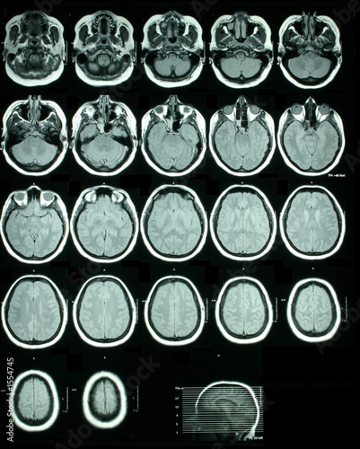 a sheet of mri (magnetic resonance images) of the photo