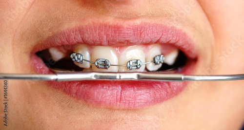 orthodontie #1644360