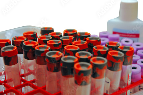 blood tests