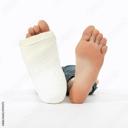 girl with a broken leg