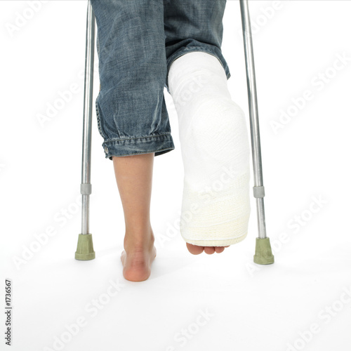 girl with a broken leg