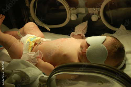 newborn in isolette 2