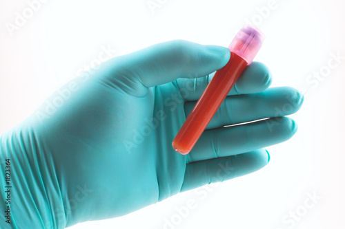 blood sample