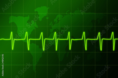 cardiogram heart rhythm3
