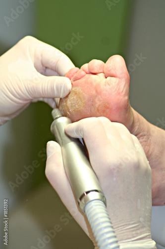 medizinische fusspflege