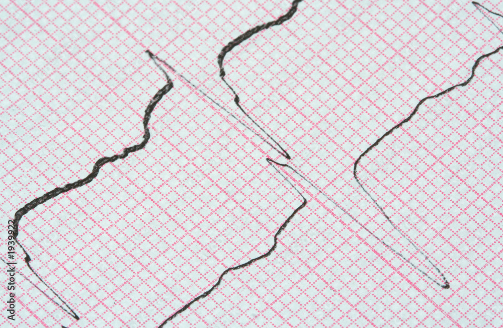 ecg graph ecg graph