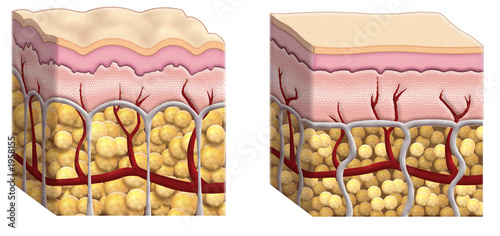 cellulite cross section photo