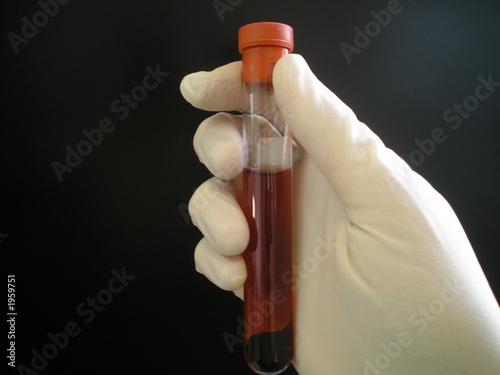 a hand in a medical glove holding a test tube