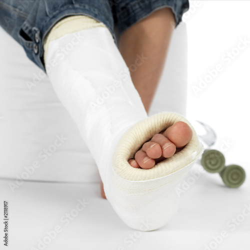 girl with a broken leg
