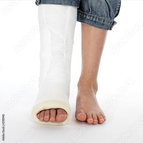 girl with a broken leg