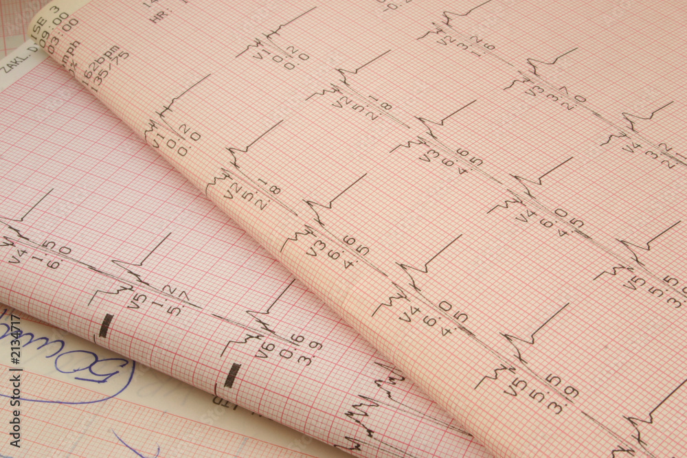 cardiological test results