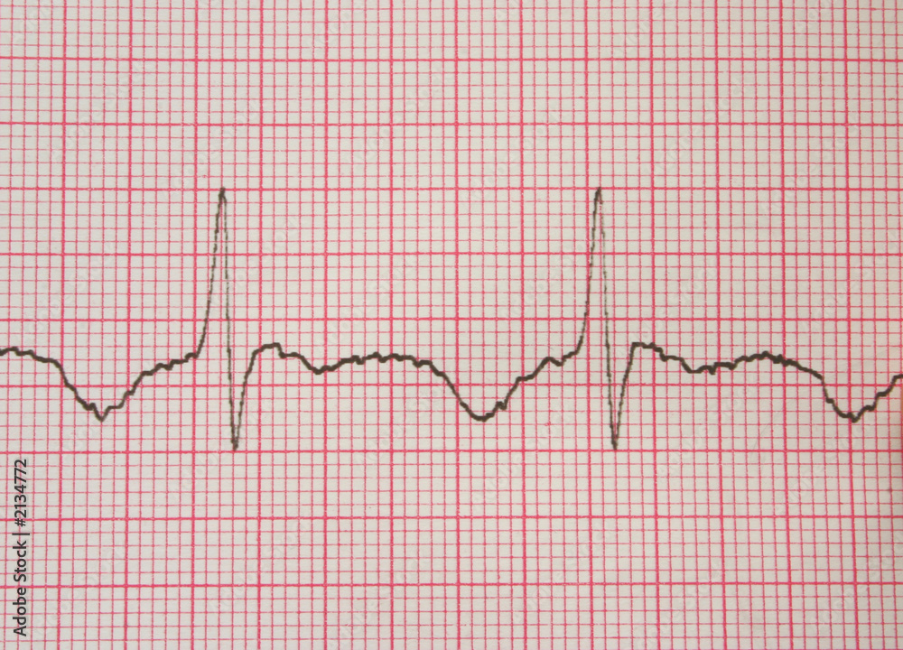 Naklejka premium ecg graph