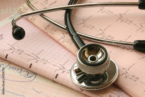 cardiological test analysis photo