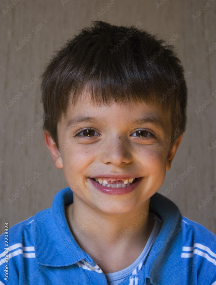 zahnlückenboy zahnlückenboy