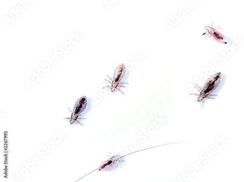 head lice