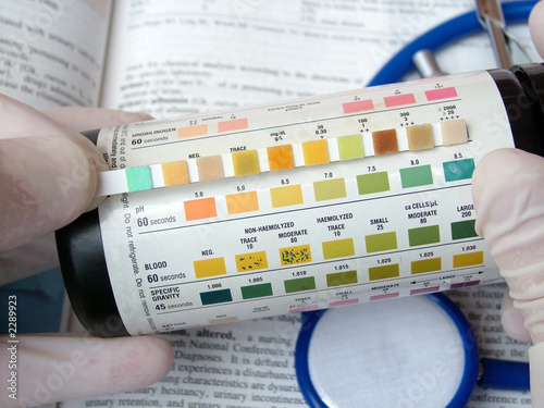 urine test diagnosis photo