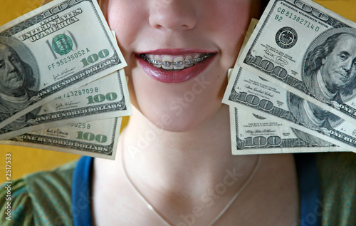 expensive braces