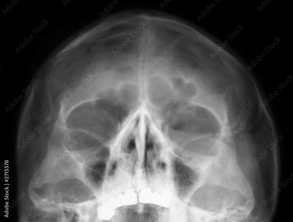 head head