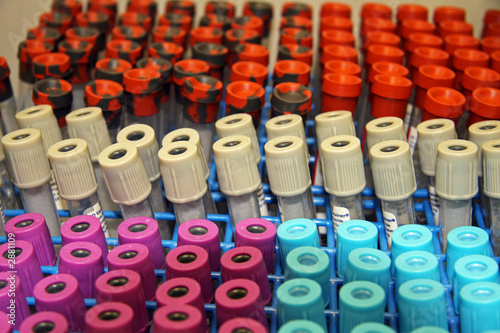 test tubes