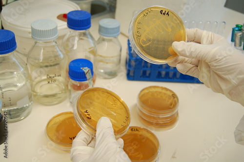 working in lab with petri dishes photo