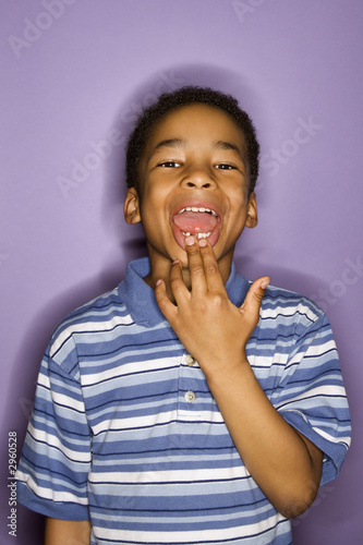 Young boy showing where his tooth fell out.