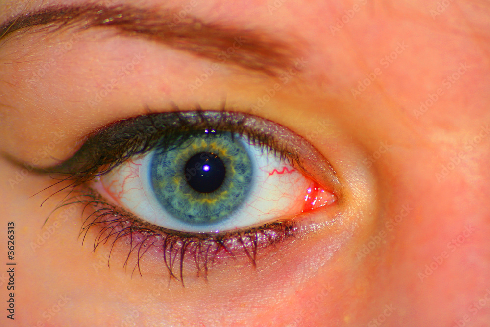 eye eye