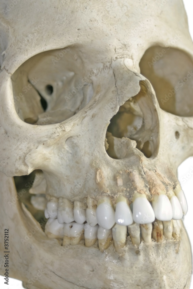 Human skull