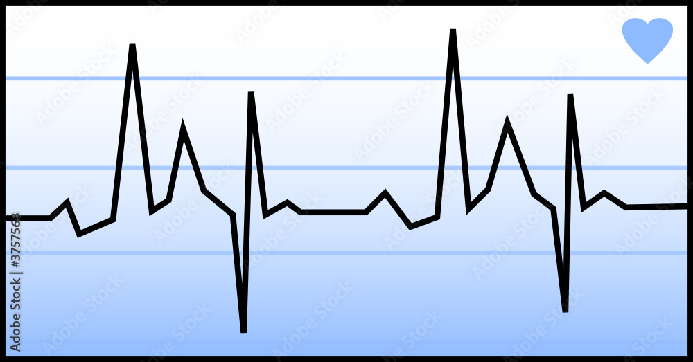 Electrocardiogramme bleu