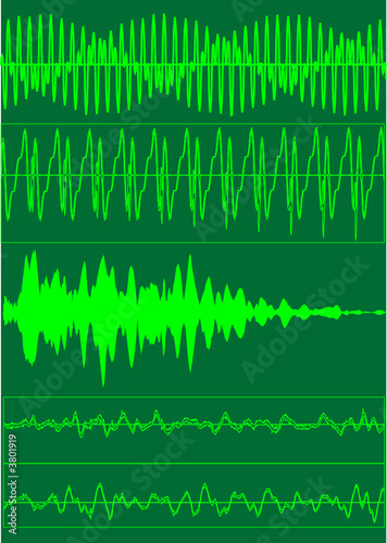 Sound waves  - vector illustration