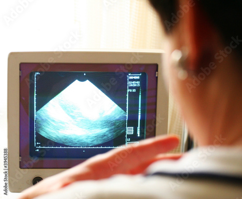Valokuva Baby - Gynaecologist see a bebe on a monitor
