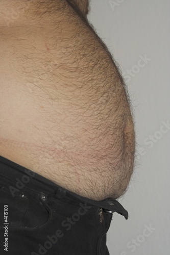 dicker Bauch