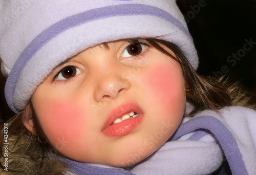 Rosy Cheeks