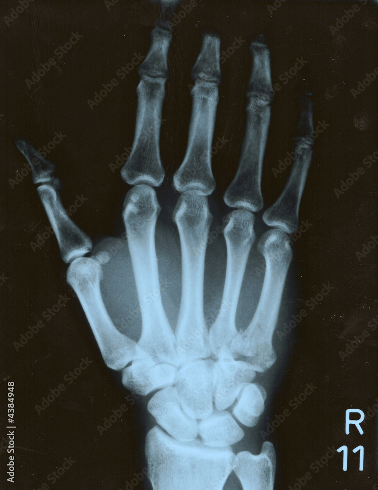 Rechte Hand Rechte Hand