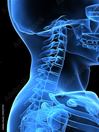 röntgenbild nacken