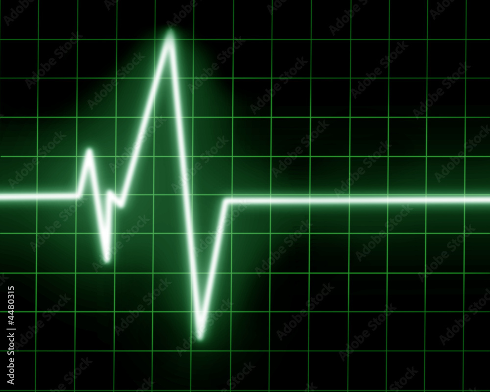 Heart monitor Heart monitor