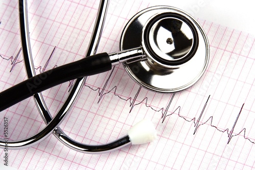 A stethoscope over a electrocardiogram close up.