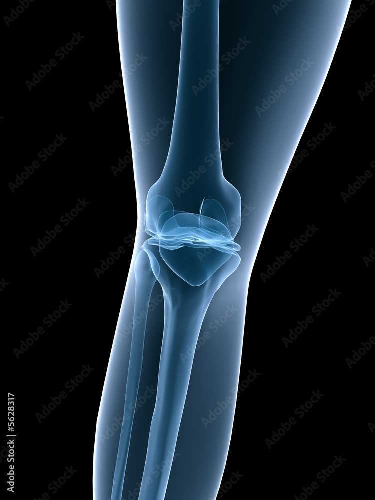röntgenaufnahme knie