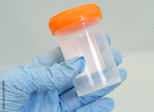 Obraz na plátně medical specimen collection bottle in gloved hand