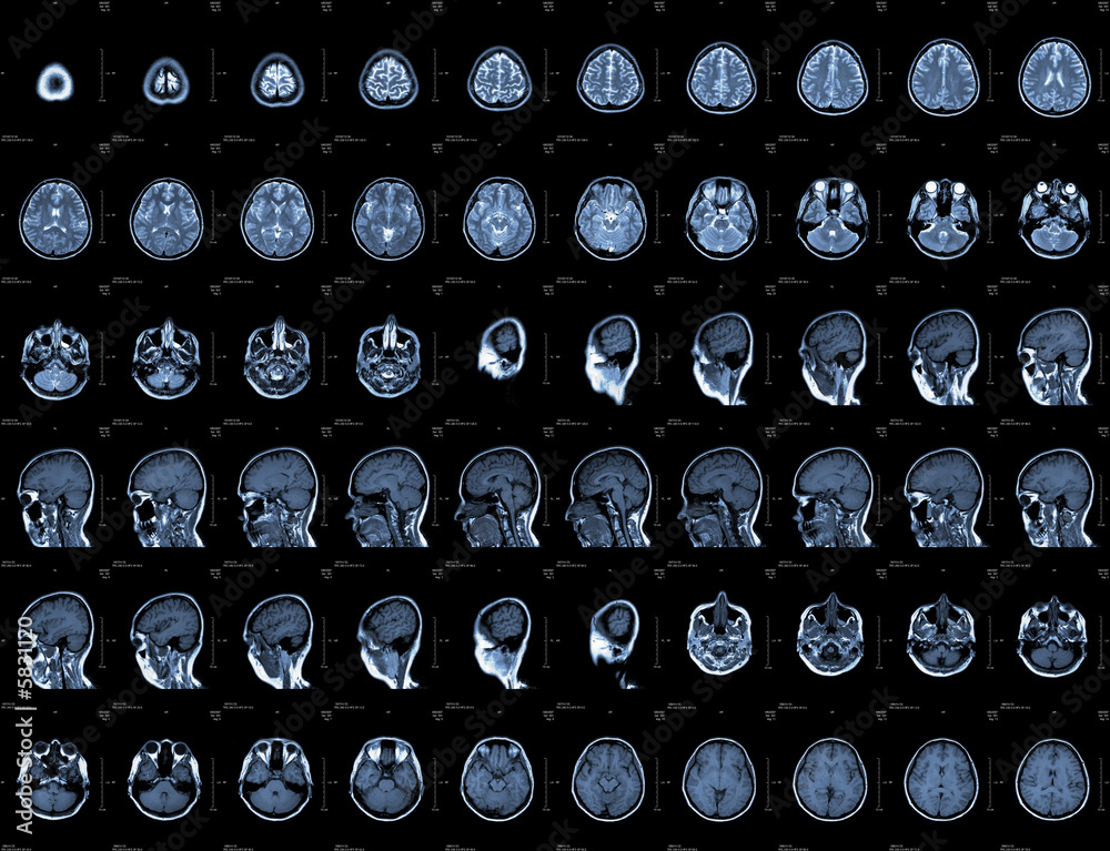 Naklejka premium Brain and head MRI or CT images