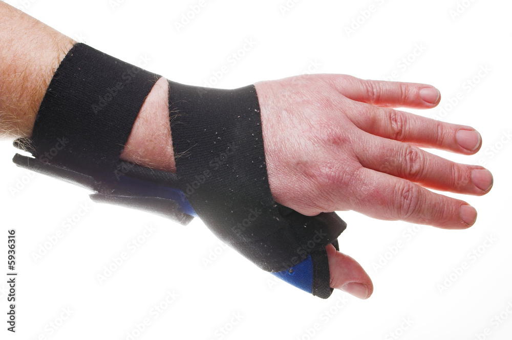 A stiff fabric brace for broken or sprained wrists. Stock 写真 Adobe Stock