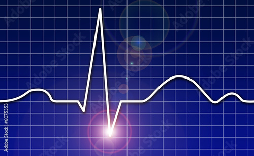 EKG  Herz  Kardiogramm