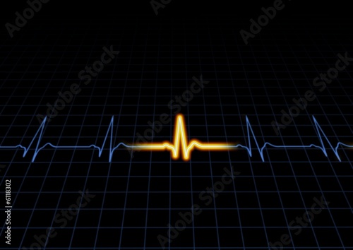 Heart machine display