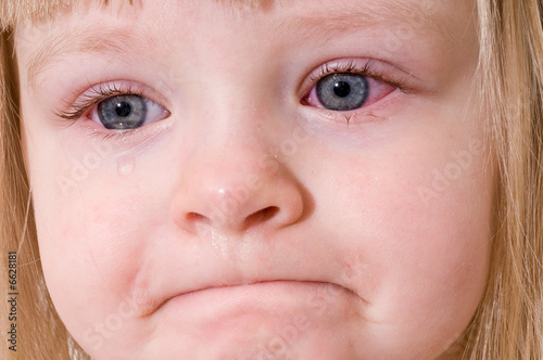 Sad Little Girl