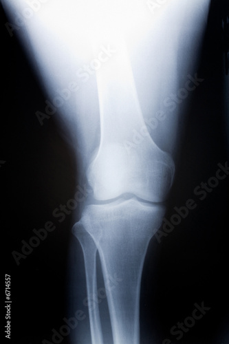 knee x-ray image